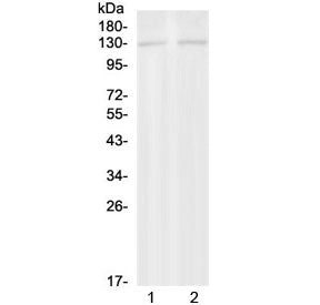 Western blot testing of 1) rat brain and 2) mouse brain with PSD antibody at 0.5ug/ml. Predicted mol