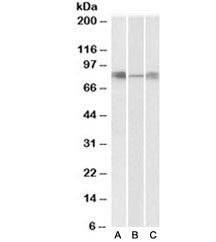 Western blot testing of human [A], mouse [B] and rat [C] lung lysates with DLL4 antibody at 0.3ug/ml