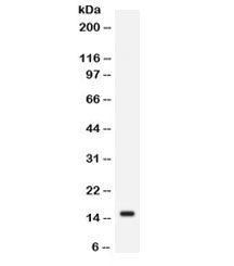 Western blot testing of human SW620 cell lysate with FABP2 antibody. Expected/observed molecular wei