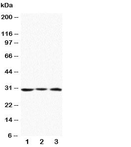 Western blot testing of Apolipoprotein D antibody and Lane 1: MCF-7; 2: HeLa; 3: SMMC-7721 cell lysa