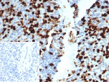 CD133 Antibody / PROM1 / Extracellular Region