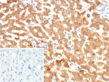 IHC staining of FFPE human liver tissue with KNG1 antibody (clone KNG1/7422). Inset: PBS used in pla
