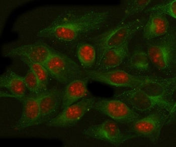 Immunofluorescent staining of FFPE human HeLa cells with NAT10 antibody (red) and Beta Tubulin mAb (