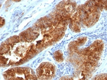 TAG-72 Antibody Cocktail