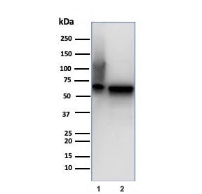 HSP60 Antibody