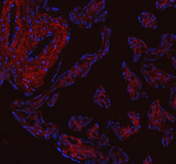 Immunofluorescent staining of FFPE human placental tissue with Collagen 1 antibody (red) and DAPI counterstain (blue). HIER: boil tissue sections in pH8 EDTA buffer, for 10-20 min and allow to cool before testing.