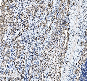 C/EBP beta Antibody