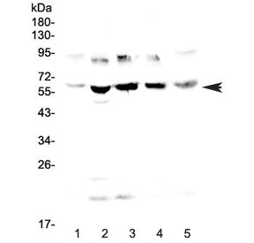 Western blot testing of human 1) HeLa, 2) placenta, 3) MCF7, 4) HepG2 and 5) PANC-1 lysate with Ster