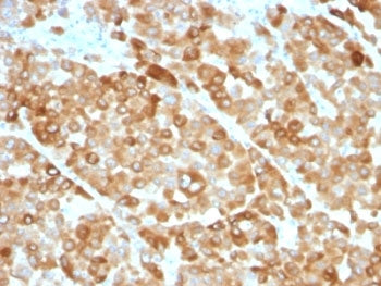 Tyrosinase Antibody