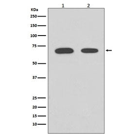 Western blot testing of human 1) HeLa and 2) 239T cell lysate with CHEK2 antibody. Predicted molecul