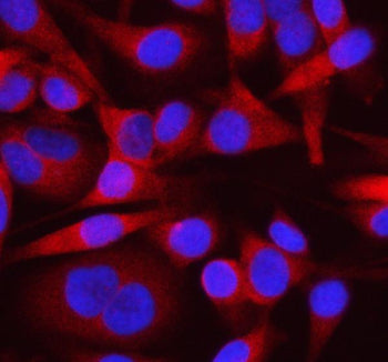 Immunofluorescent staining of OTUD3 using anti-OTUD3 antibody (red). OTUD3 was detected in an immuno