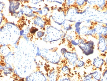 Transglutaminase 2 Antibody