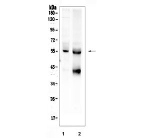 Western blot testing of human 1) HeLa and 2) SW579 cell lysate with TGFBR1 antibody. Expected molecu