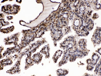 PNP Antibody / Purine Nucleoside Phosphorylase