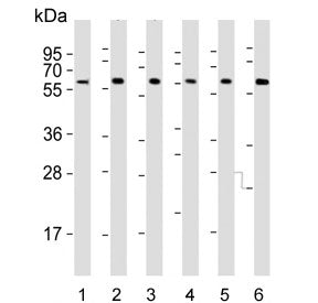 Western blot testing of human 1) spleen, 2) Jurkat, 3) Daudi, 4) KG1, 5) MOLT4 and 6) HL60 cell lysa