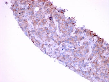 IHC testing of FFPE human bladder with EGF Receptor antibody (clone GFR/1667). HIER: boil tissue sec