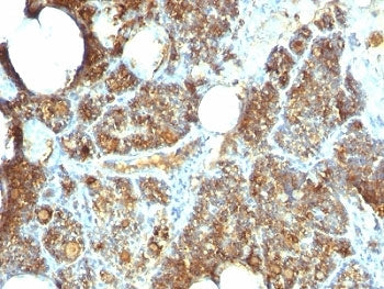 IHC: Formalin-fixed, paraffin-embedded human parathyroid stained with Parathyroid Hormone antibody (