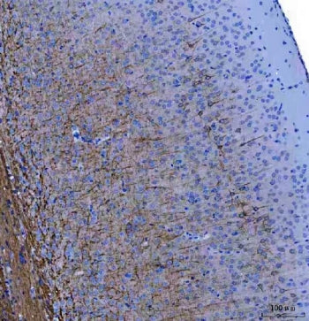 IHC staining of FFPE mouse brain tissue with Light Chain Neurofilament antibody. HIER: boil tissue s