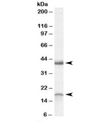 Western blot testing of rat brain lysate with Ramp1 antibody at 0.3ug/ml. Routinely observed at ~18k