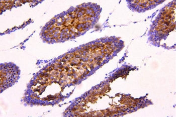 IHC staining of FFPE rat testis tissue with ACACB antibody. HIER: boil tissue sections in pH8 EDTA f
