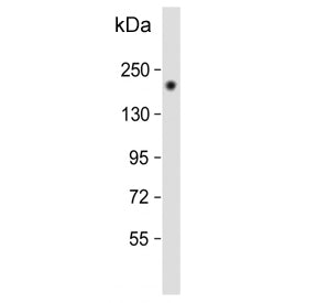 Western blot testing of human SK-BR-3 cell lysate with ErbB2 antibody. Expected molecular weight: 13
