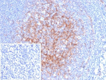 ICAM1 Antibody / CD54