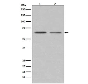 Western blot testing of human 1) MCF7 and 2) T-47D cell lysate with ER alpha antibody. Predicted mol