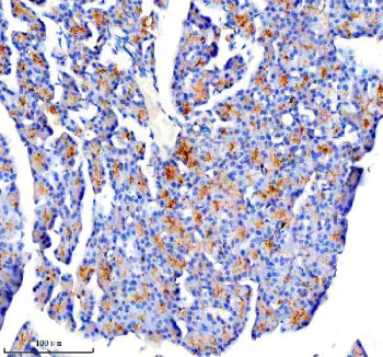 Immunohistochemical staining of CTRC using anti-CTRC antibody. CTRC was detected in a paraffin-embed