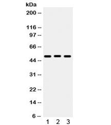 Western blot testing of 1) rat liver, 2) mouse liver, 3) human A549 lysate with BMP5 antibody. Expec