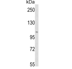 Western blot testing of human HeLa cell lysate with PI3KC3 antibody. Predicted molecular weight ~102