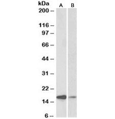Western blot testing of human amygdala [A] and fetal mouse [B] brain lysate with alpha-Synuclein ant