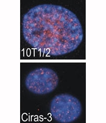 Indirect IF analysis showed that RSKB is localized in the nucleus of parental (10T1/2) and oncogene-