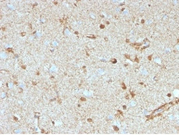 IHC staining of FFPE human brain tissue with S100B antibody (clone S100B/4153) at 2ug/ml. HIER: boil tissue sections in pH 9 10mM Tris with 1mM EDTA for 20 min and allow to cool before testing.