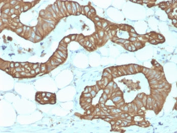 IHC testing of FFPE human colon tissue with recombinant KRT19 antibody (clone KRT19/1959R). Required