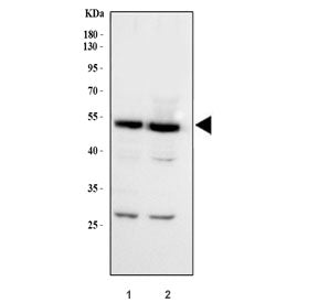 Western blot testing of human 1) HeLa and 2) 293T cell lysate with XIAP antibody. Expected molecular