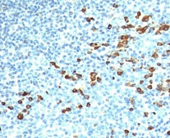 IgM Heavy Chain Antibody