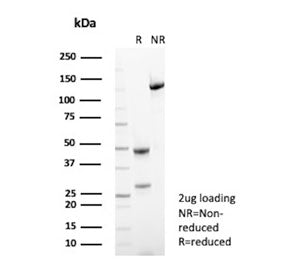 SDS-PAGE analysis of purified, BSA-free Alkaline Phosphatase antibody (clone SPM372) as confirmation