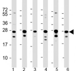 Western blot testing of human 1) HeLa, 2) HepG2, 3) Jurkat, 4) Raji, 5) 293 and 6) 293T/17 cell lysa