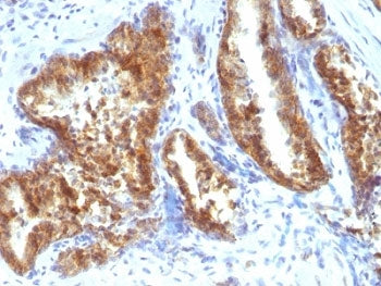 AMACR / p504S Antibody (Prostate Cancer Marker)