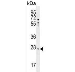 Western blot testing of human HepG2 cell lysate with NR0B2 antibody. Predicted molecular weight ~28 