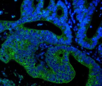 Immunofluorescent staining of FFPE human placental tissue with Keratin 18 antibody (green) and DAPI 