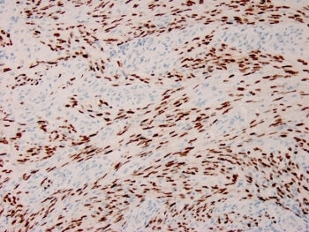 HHV8 Antibody / Human Herpes Virus 8