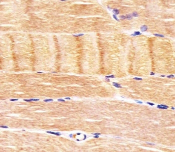 IHC testing of FFPE human skeletal muscle tissue with CDK5 antibody. HIER: steam section in pH6 citr