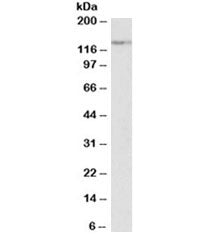 Western blot testing of human Daudi lysate with MERTK antibody at 2ug/ml. Predicted molecular weight