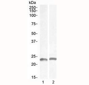 Western blot testing of 1) mouse colon and 2) rat colon lysate with LIF antibody at 0.5ug/ml. Observ