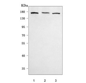 Western blot testing of 1) human U-87 MG, 2) human 293T and 3) rat C6 cell lysate with mGluR5 antibo