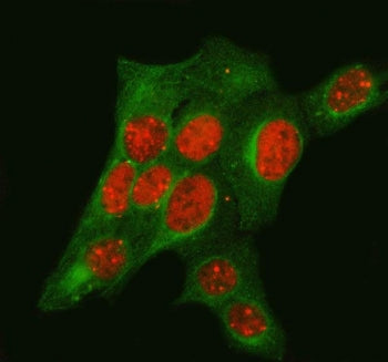 Immunofluorescent staining of FFPE human U-2 OS cells with TP53BP1 antibody (red) and Beta Tubulin m