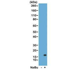 Western Blot of acid extracts from human HeLa cells untreated (-) or treated (+) with sodium butyrat