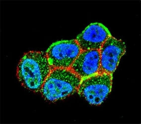 Confocal immunofluorescent analysis of LKB1 antibody with ZR-75-1 cells followed by Alexa Fluor 488-