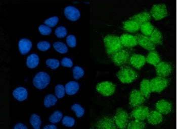 Immunofluorescent staining of FFPE human MCF7 cells with LSM2 antibody (green) and DAPI nuclear stai